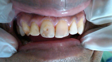 Dental Clinic in Mumbai